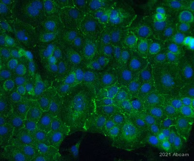 Trop2 Antibody Epr20043 Ab214488 Immunocytochemistry Img429573