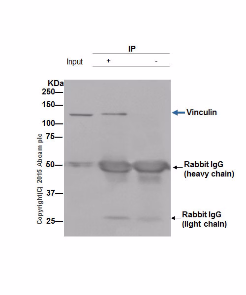 Vinculin Antibody Epr8185 Ab129002 Immunoprecipitation Img7981