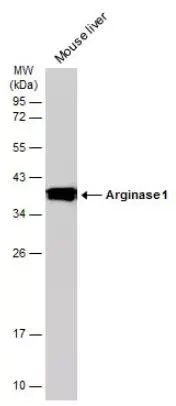 Anti-Liver Arginase antibody(AB96183)