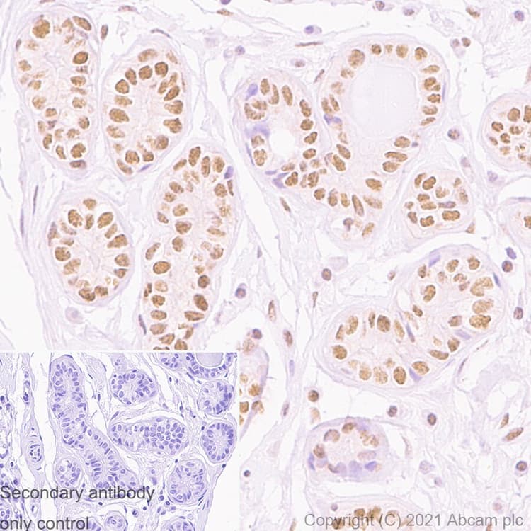 Anti-PMS2 antibody [EPR3947](AB110638)