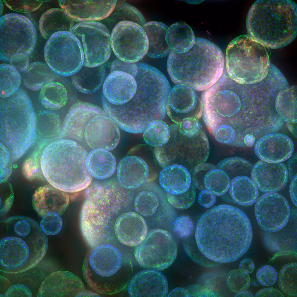 Molecular Devices Imagexpress Confocal Ht Ai Organoid Encoded Image3