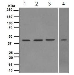 Anti-TDP43 antibody [EPR5810](AB109535)