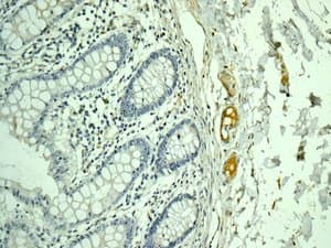 C9 Antibody Epr11232 82 Bsa And Azide Free Ab240175  Immunohistochemistry Formalin Pfa Fixed Paraffin Embedded Sections Img134509