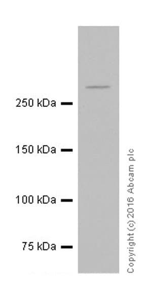 Anti-ATM antibody [EPR20100] - ChIP Grade(AB201022)
