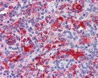 Rig I Ddx58 Antibody Ab111037  Immunohistochemistry Formalin Pfa Fixed Paraffin Embedded Sections Img102243