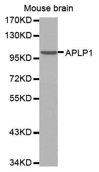 Aplp1 Antibody Ab192481  Western Blot Img22453