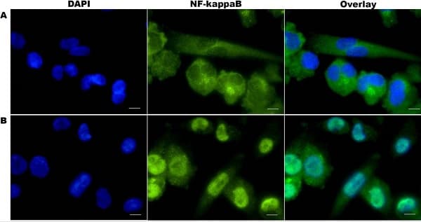 Anti-NF-kB p65 antibody [E379](AB32536)
