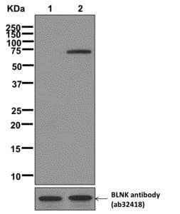Blnk Phospho Y84 Antibody Ep22022 Ab174837  Western Blot Img109131