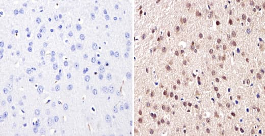 Anti-Dnmt3b antibody(AB2851)