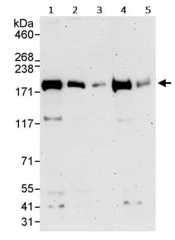Vprbp Antibody Ab245483  Western Blot Img66784
