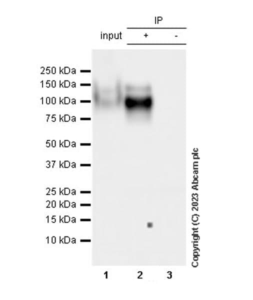 Trkc Antibody Epr22959 404 Ab313761  Immunoprecipitation Img419008