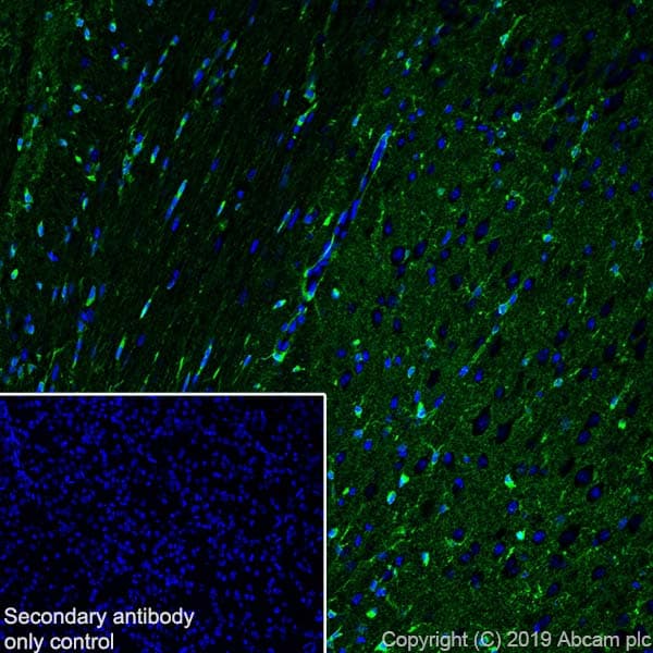 Anti-Glutamine Synthetase antibody [EPR13022(B)](AB176562)