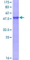 Recombinant Human Fc epsilon RI/FCER1A protein(AB114334)