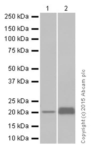 Rbp4 Antibody Ep3657 Ab109193  Western Blot Img61886