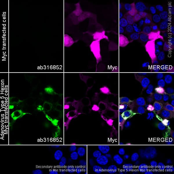 Anti-Adenovirus Type 5 Hexon antibody [EPR28237-57](AB316852)