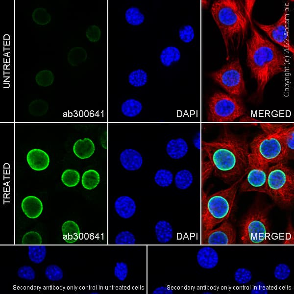 Anti-Histone H3 (acetyl K4+K9+K14+K18+K23+K27) antibody [RM1045] - BSA and Azide free(AB300642)