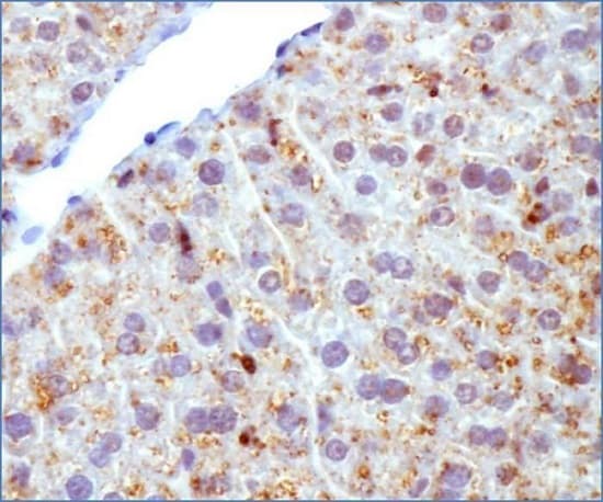 Anti-Perilipin 2 antibody(ab52356)