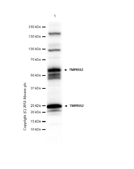Anti-TMPRSS2 antibody [EPR3862](AB109131)