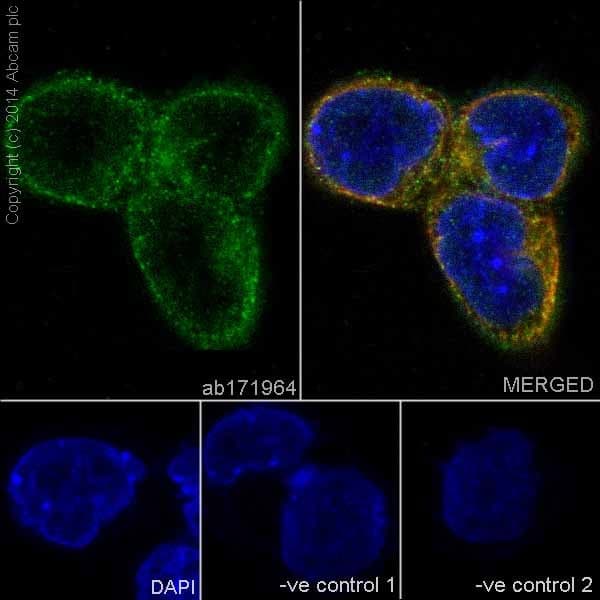Anti-Dynein intermediate chain 1/DNAI1 antibody [EPR11244-61](AB171964)
