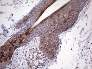 Gli2 Antibody Oti1f9 Ab187386  Immunohistochemistry Formalin Pfa Fixed Paraffin Embedded Sections Img56414