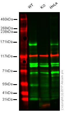 Anti-KDM5B / PLU1 / Jarid1B antibody [EPR12704](AB181089)