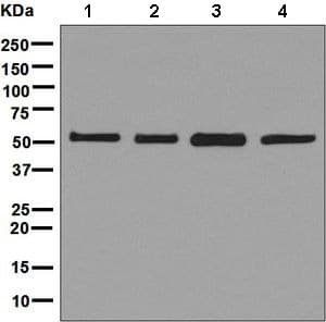Vps4b Mig1 Antibody Epr9225 Bsa And Azide Free Ab248775  Western Blot Img114996