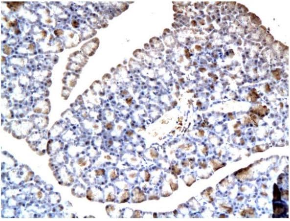 Abcb11 Bsep Antibody Ab217532  Immunohistochemistry Formalin Pfa Fixed Paraffin Embedded Sections Img119409