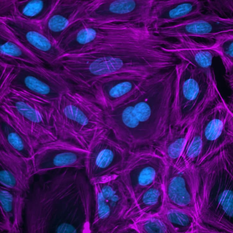 Molecular Devices Imagexpress Confocal Ht Ai Cell Painting Action Image4