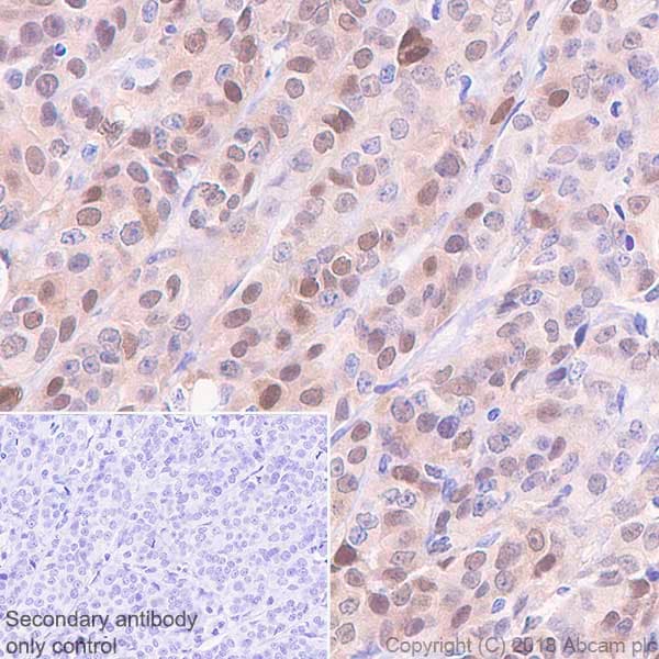Anti-Visfatin antibody [EPR21984] - BSA and Azide free(AB240560)