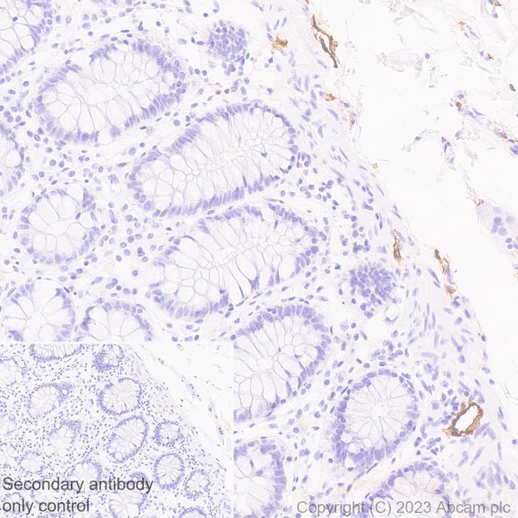 Anti-LYVE1 antibody [RM1067](AB314241)