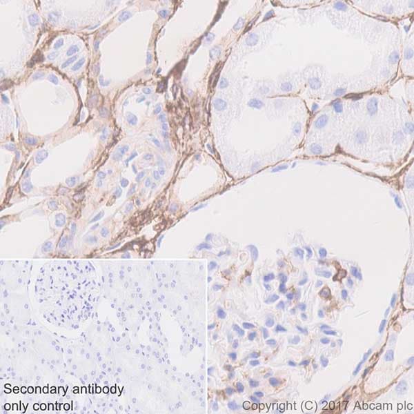 Anti-CD44 antibody [EPR18668](AB189524)