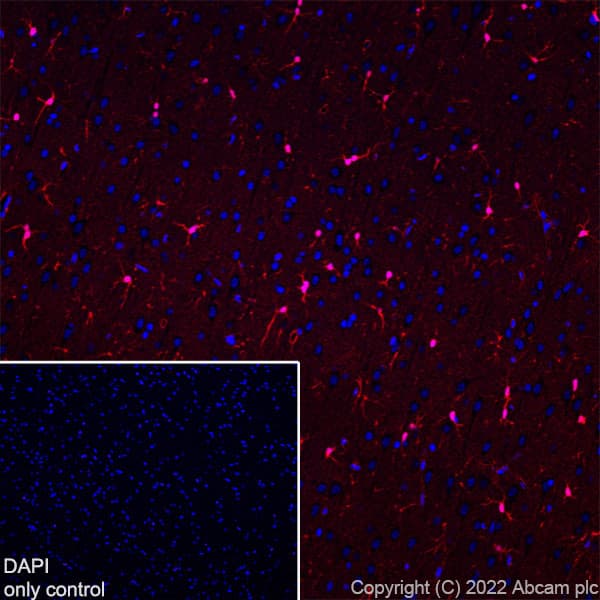 Alexa Fluor® 594 Anti-S100 beta antibody [EP1576Y] - Astrocyte Marker(AB307851)