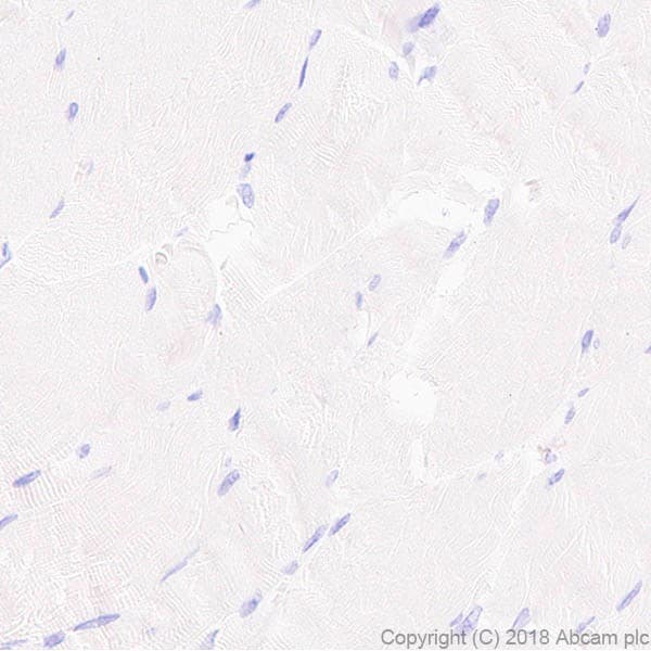 Anti-Surfactant protein D/SP-D antibody [EPR21928-209] - BSA and Azide free(AB234257)