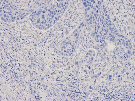 Anti-Ferritin Light Chain antibody(AB186871)