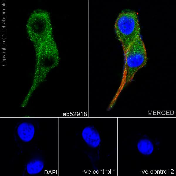 Anti-proNGF antibody [EP1320Y] - Low endotoxin, Azide free(AB221609)