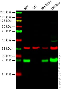 Anti-PGP9.5 antibody [31A3](AB20559)