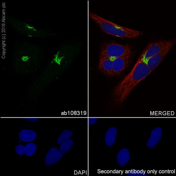 Neuroinflammation Marker (BDNF, ICAM1, TREM2, GFAP, TNF alpha, Iba1) Antibody Panel - Human(AB263462)