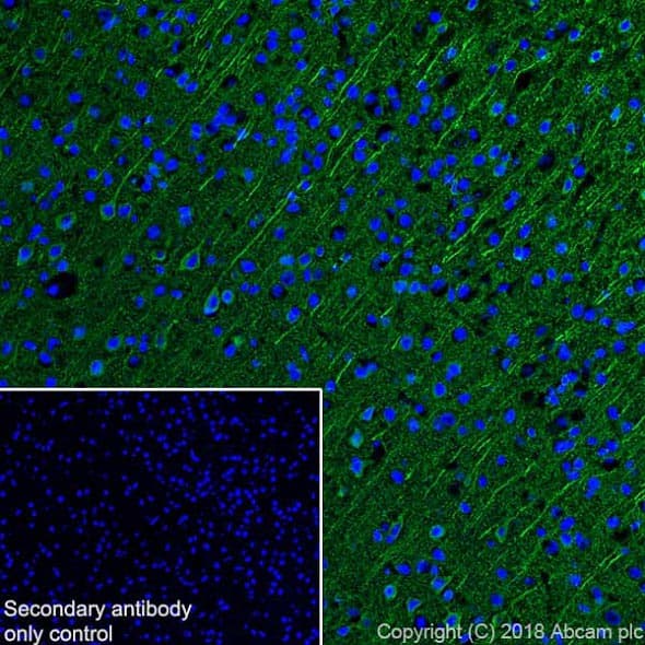 Anti-MAP2 antibody [EPR22036-127](AB221693)