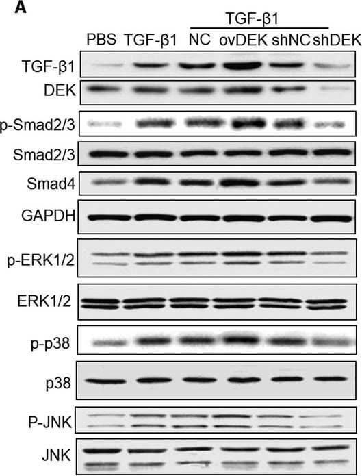 Anti-Smad2 + Smad3 antibody [EPR19557-4] - ChIP Grade(AB202445)