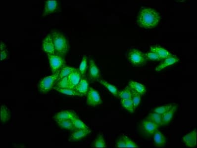 Hmgcs2 Antibody Ab236667  Immunocytochemistry Immunofluorescence Img126465