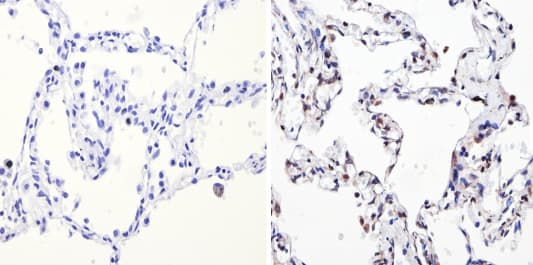 Anti-NCOR2/SMRT antibody(ab5802)