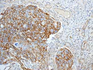 Anti-beta Catenin antibody [E247] - ChIP Grade(AB32572)