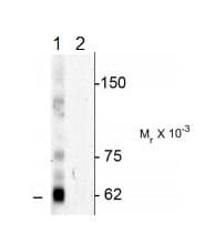 Nucleoporin P62 Nup62 Phospho T269 S272 Antibody Ab183480  Western Blot Img22114