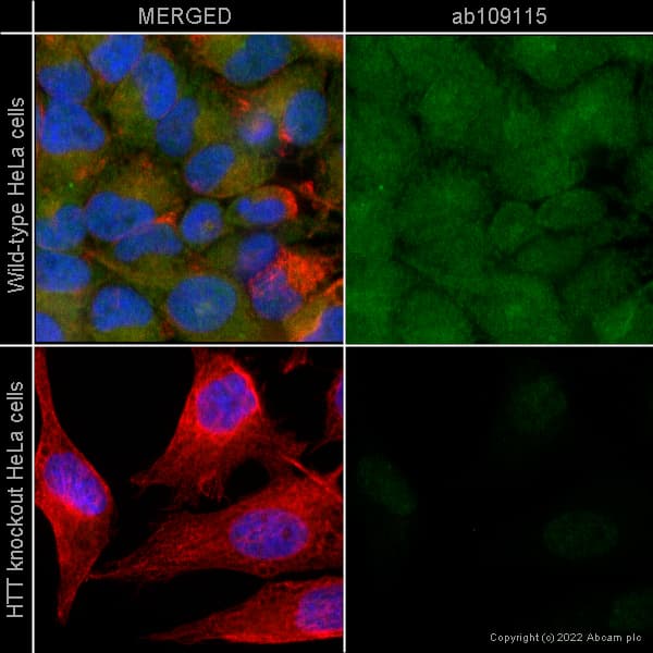 Anti-Huntingtin antibody [EPR5526](AB109115)