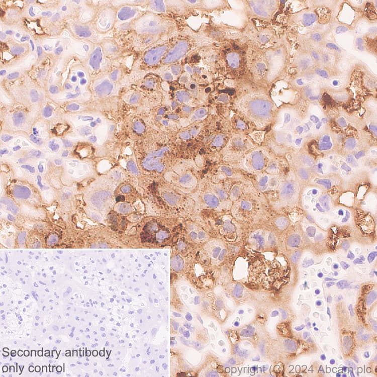 Pai1 Antibody Epr21850 262 Bsa And Azide Free Ab317605  Immunohistochemistry Formalin Pfa Fixed Paraffin Embedded Sections Img431900