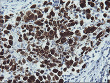 Magea4 Antibody Oti1f9 Ab139297  Immunohistochemistry Formalin Pfa Fixed Paraffin Embedded Sections Img101353