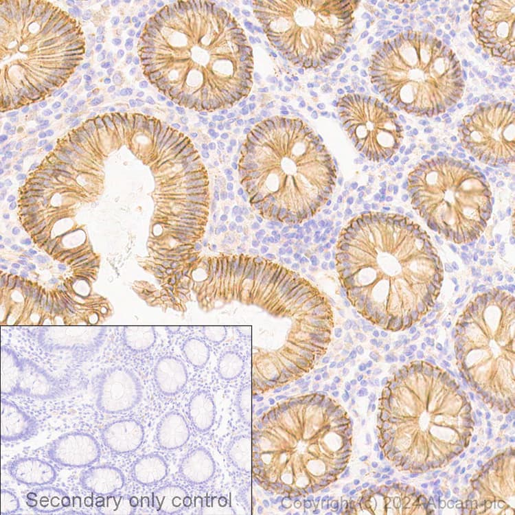 Anti-beta Catenin antibody [E247] - ChIP Grade(AB32572)