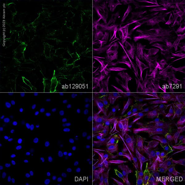 Anti-NG2 antibody(AB129051)