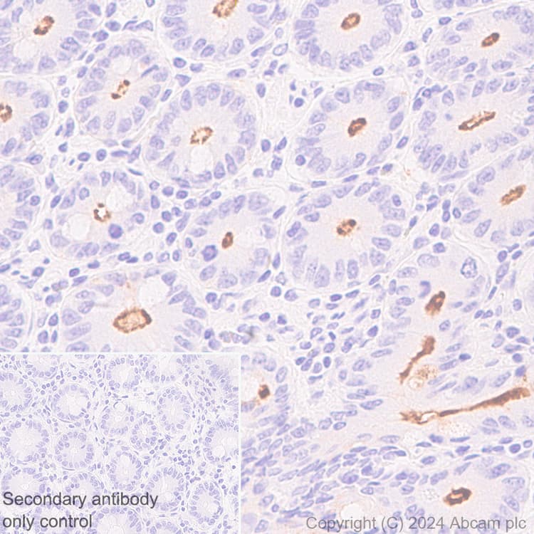 Muc17 Antibody Epr28482 85 Ab316971  Immunohistochemistry Formalin Pfa Fixed Paraffin Embedded Sections Img429267