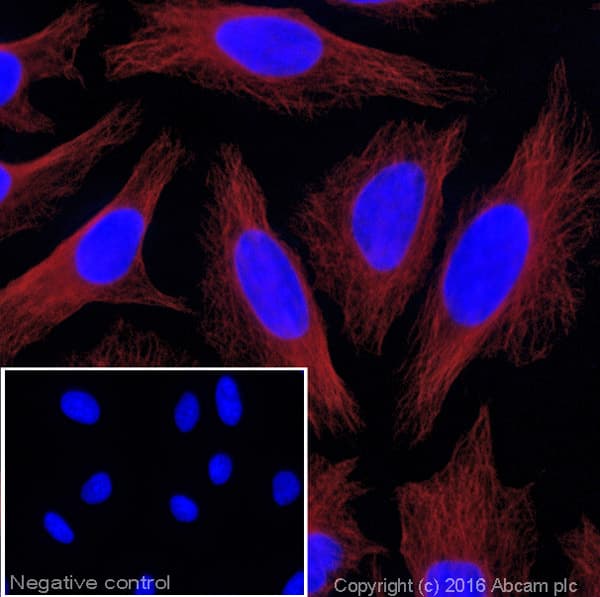 Donkey Anti-Mouse IgG H&L (Alexa Fluor® 647)(AB150107)